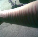 Emo Arm Cutting